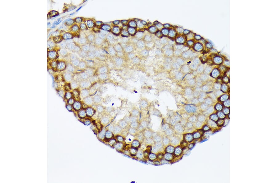 Immunohistochemistry - Anti-USP9x Antibody [ARC1748] (A307898) - Antibodies.com