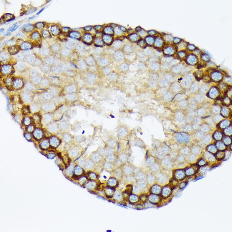 Immunohistochemistry - Anti-USP9x Antibody [ARC1748] (A307898) - Antibodies.com