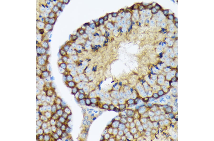 Immunohistochemistry - Anti-USP9x Antibody [ARC1748] (A307898) - Antibodies.com