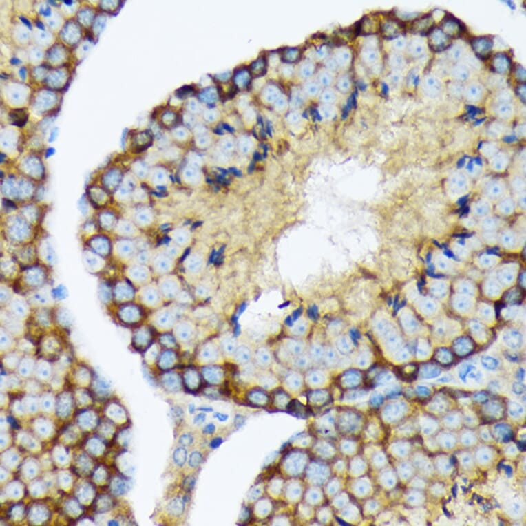 Immunohistochemistry - Anti-USP9x Antibody [ARC1748] (A307898) - Antibodies.com