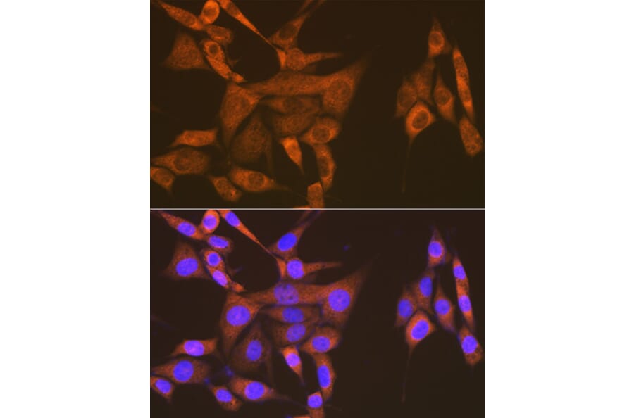Immunofluorescence - Anti-USP9x Antibody [ARC1748] (A307898) - Antibodies.com