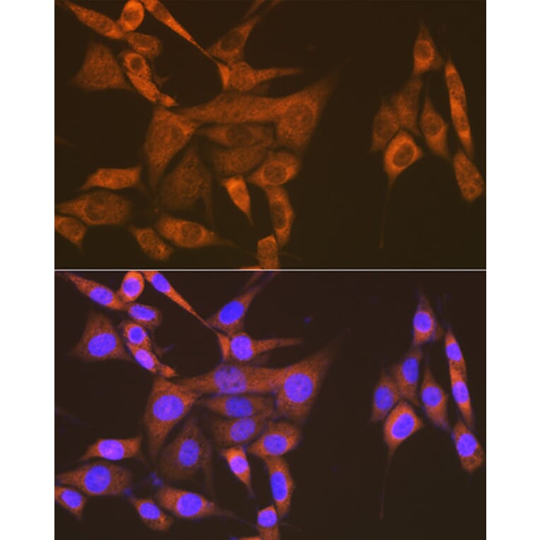 Immunofluorescence - Anti-USP9x Antibody [ARC1748] (A307898) - Antibodies.com