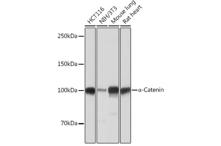 Western Blot - Anti-CTNNA1 Antibody [ARC0348] (A307899) - Antibodies.com