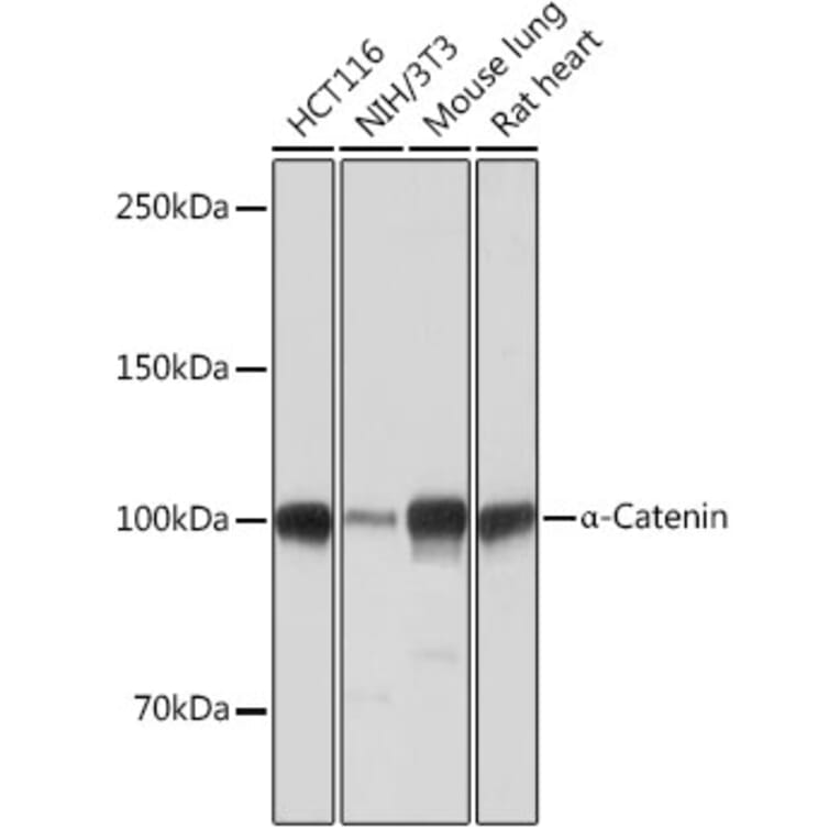 Western Blot - Anti-CTNNA1 Antibody [ARC0348] (A307899) - Antibodies.com