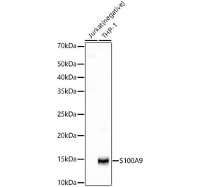 Western Blot - Anti-S100A9 Antibody [ARC55864] (A307900) - Antibodies.com