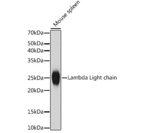 Western Blot - Anti-Lambda Light chain Antibody [ARC2357] (A307901) - Antibodies.com