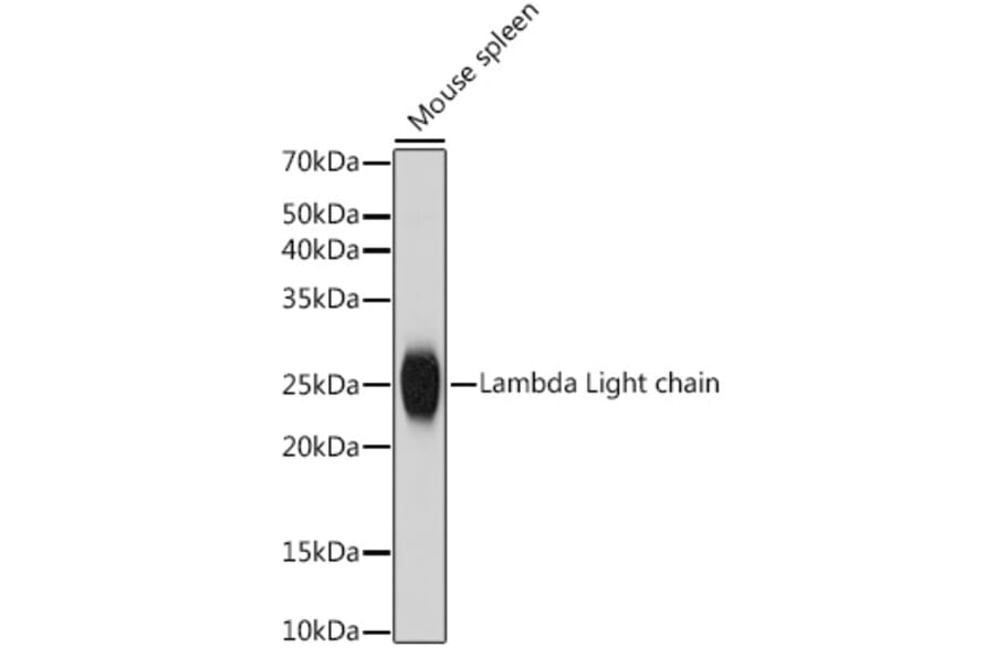 Western Blot - Anti-Lambda Light chain Antibody [ARC2357] (A307901) - Antibodies.com