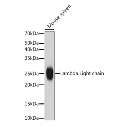 Western Blot - Anti-Lambda Light chain Antibody [ARC2357] (A307901) - Antibodies.com