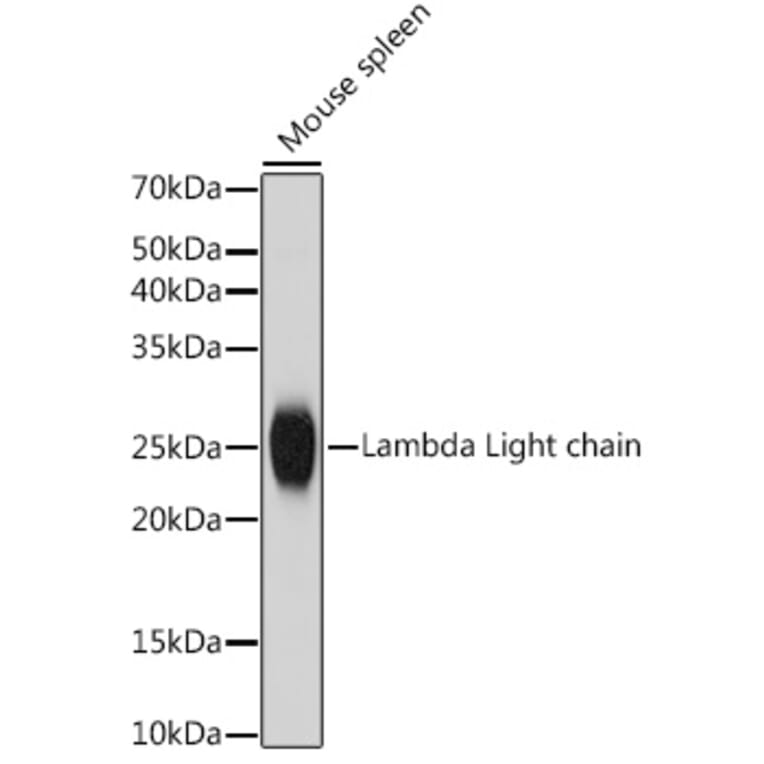 Western Blot - Anti-Lambda Light chain Antibody [ARC2357] (A307901) - Antibodies.com