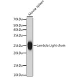 Western Blot - Anti-Lambda Light chain Antibody [ARC2357] (A307901) - Antibodies.com