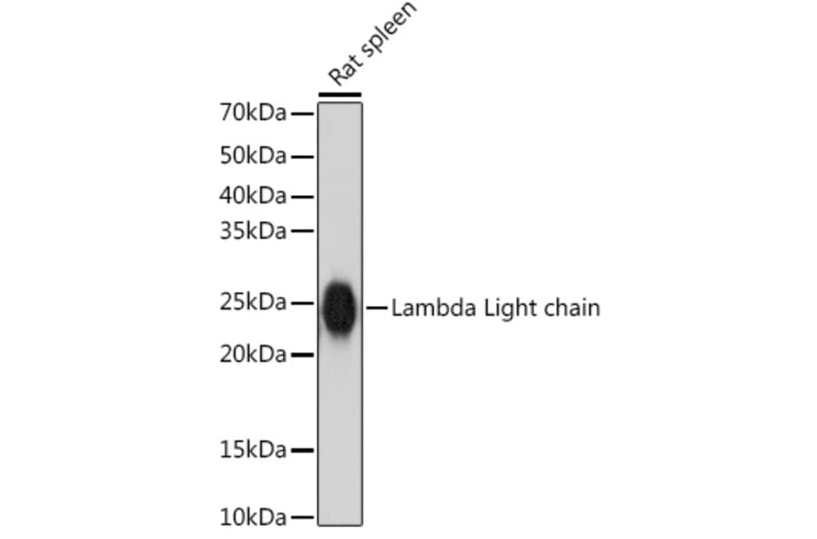Western Blot - Anti-Lambda Light chain Antibody [ARC2357] (A307901) - Antibodies.com