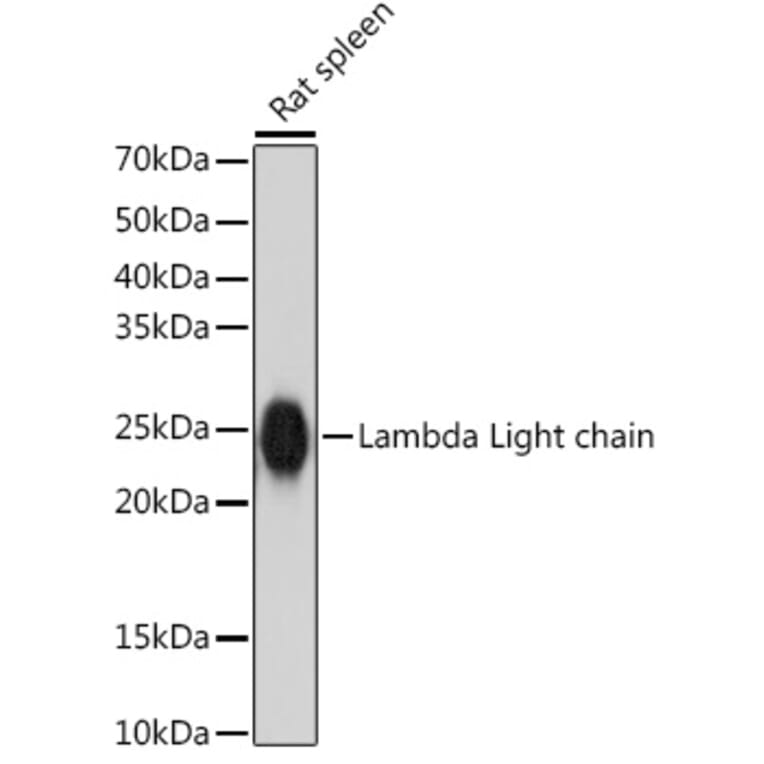 Western Blot - Anti-Lambda Light chain Antibody [ARC2357] (A307901) - Antibodies.com