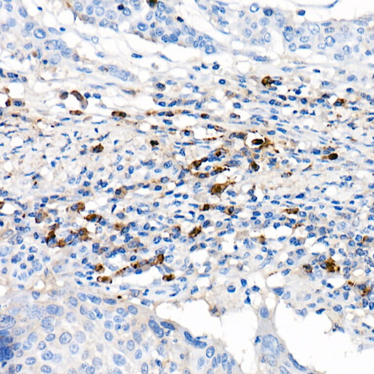 Immunohistochemistry - Anti-Lambda Light chain Antibody [ARC2357] (A307901) - Antibodies.com