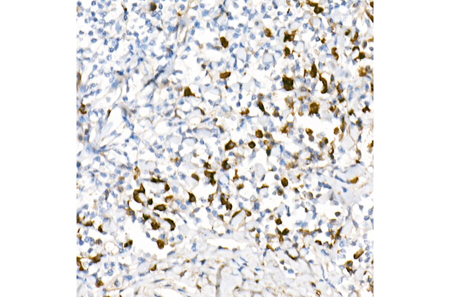 Immunohistochemistry - Anti-Lambda Light chain Antibody [ARC2357] (A307901) - Antibodies.com
