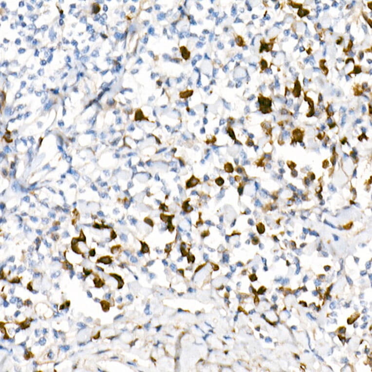 Immunohistochemistry - Anti-Lambda Light chain Antibody [ARC2357] (A307901) - Antibodies.com