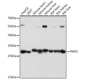 Western Blot - Anti-PNPO Antibody (A307902) - Antibodies.com