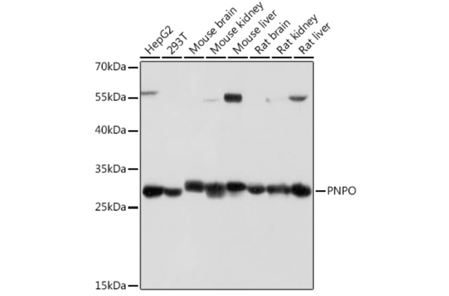 Western Blot - Anti-PNPO Antibody (A307902) - Antibodies.com