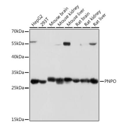 Western Blot - Anti-PNPO Antibody (A307902) - Antibodies.com