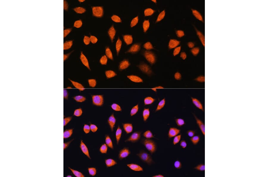 Immunofluorescence - Anti-PNPO Antibody (A307902) - Antibodies.com