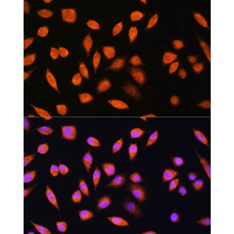 Immunofluorescence - Anti-PNPO Antibody (A307902) - Antibodies.com