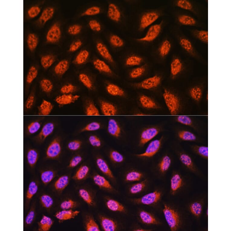 Immunofluorescence - Anti-PNPO Antibody (A307902) - Antibodies.com