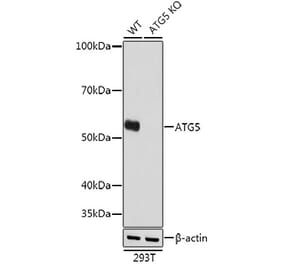 Western Blot - Anti-APG5L/ATG5 Antibody [ARC0156] (A307903) - Antibodies.com