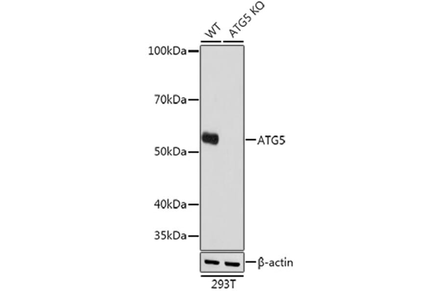 Western Blot - Anti-APG5L/ATG5 Antibody [ARC0156] (A307903) - Antibodies.com