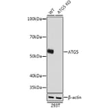 Western Blot - Anti-APG5L/ATG5 Antibody [ARC0156] (A307903) - Antibodies.com