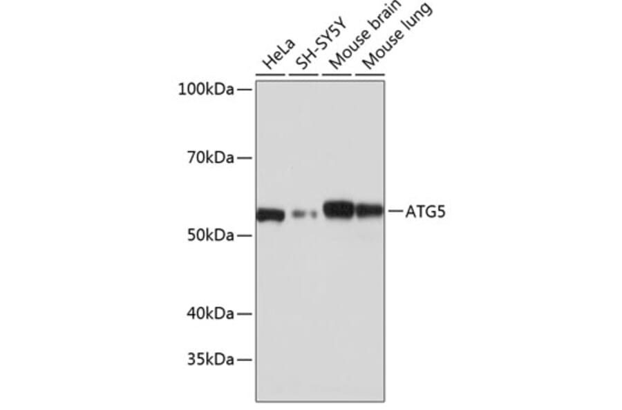 Western Blot - Anti-APG5L/ATG5 Antibody [ARC0156] (A307903) - Antibodies.com