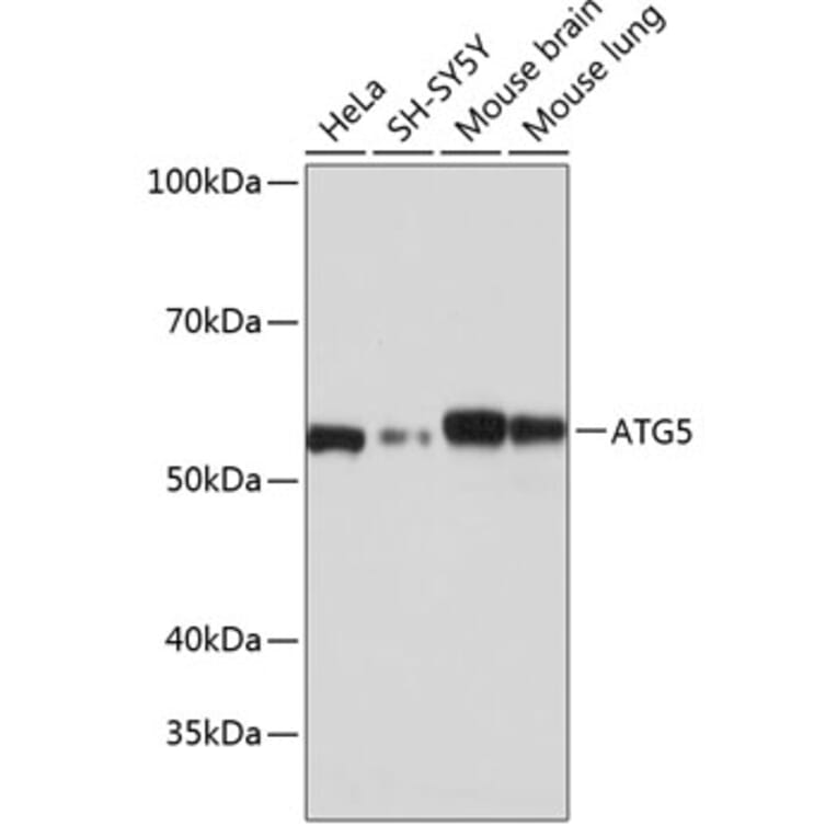 Western Blot - Anti-APG5L/ATG5 Antibody [ARC0156] (A307903) - Antibodies.com