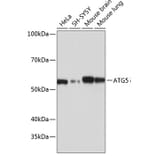 Western Blot - Anti-APG5L/ATG5 Antibody [ARC0156] (A307903) - Antibodies.com