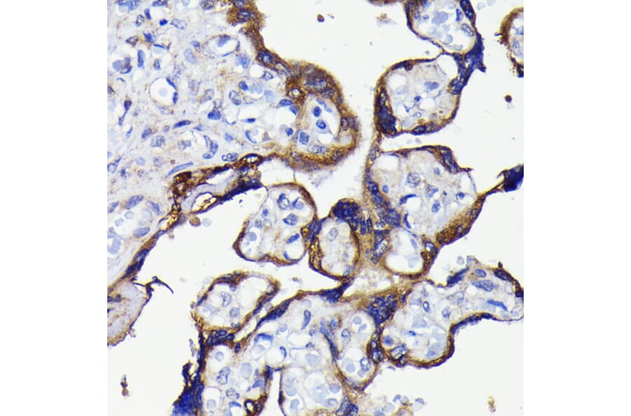 Immunohistochemistry - Anti-APG5L/ATG5 Antibody [ARC0156] (A307903) - Antibodies.com