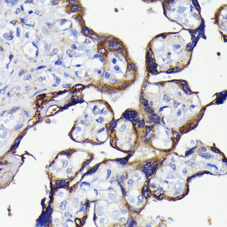 Immunohistochemistry - Anti-APG5L/ATG5 Antibody [ARC0156] (A307903) - Antibodies.com