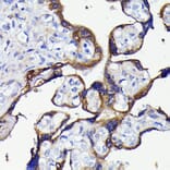 Immunohistochemistry - Anti-APG5L/ATG5 Antibody [ARC0156] (A307903) - Antibodies.com