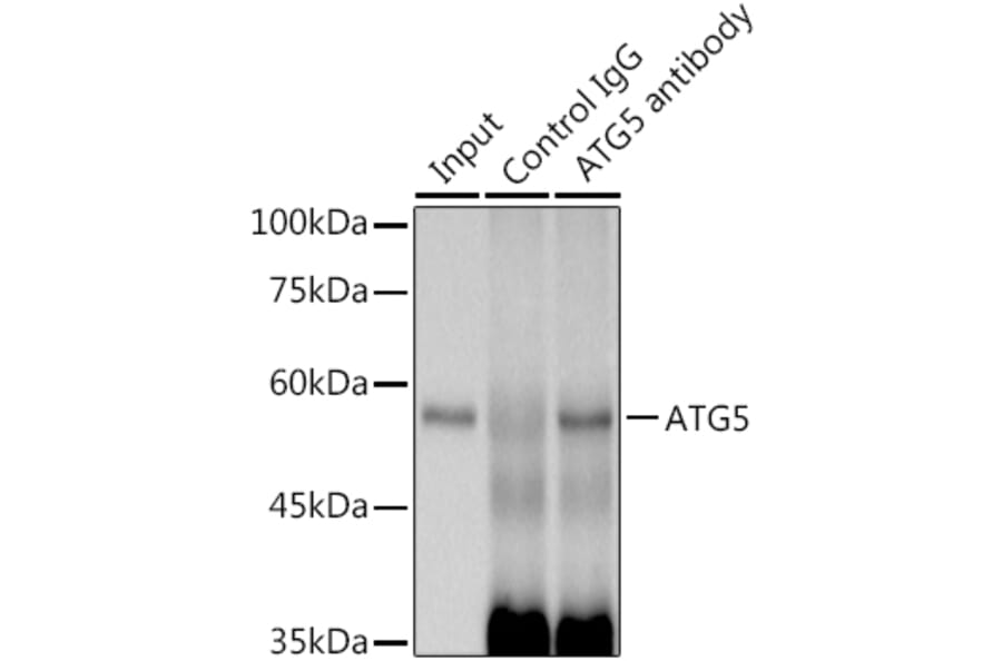 Western Blot - Anti-APG5L/ATG5 Antibody [ARC0156] (A307903) - Antibodies.com