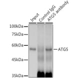 Western Blot - Anti-APG5L/ATG5 Antibody [ARC0156] (A307903) - Antibodies.com