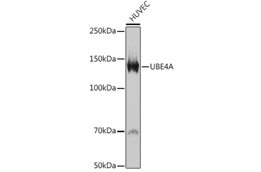 Western Blot - Anti-Ube4a Antibody [ARC2534] (A307904) - Antibodies.com