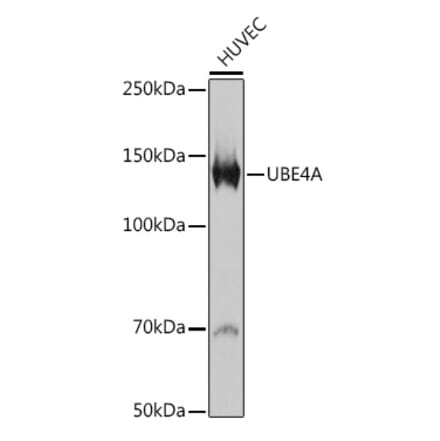 Western Blot - Anti-Ube4a Antibody [ARC2534] (A307904) - Antibodies.com