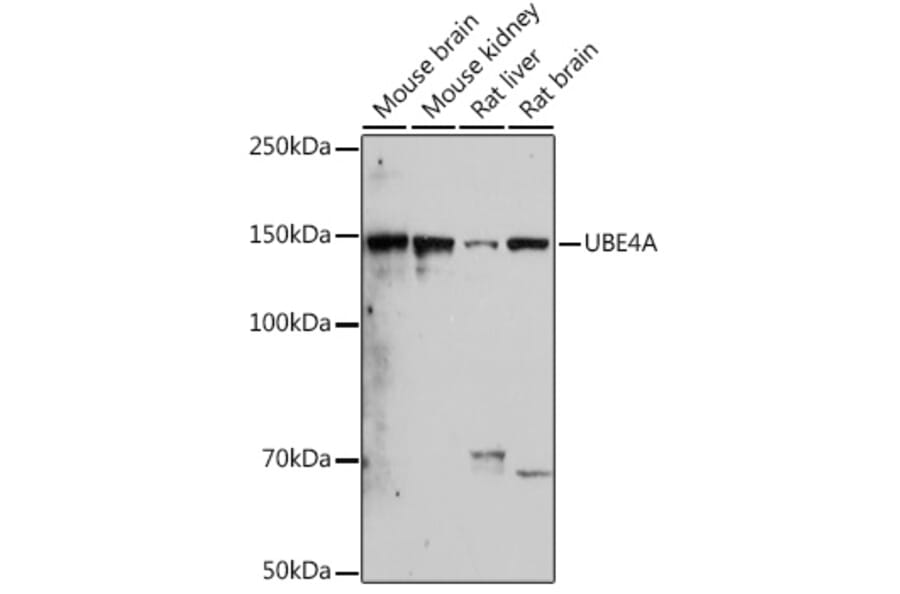 Western Blot - Anti-Ube4a Antibody [ARC2534] (A307904) - Antibodies.com