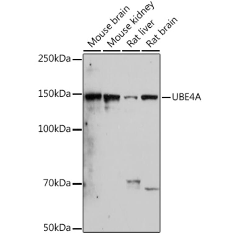 Western Blot - Anti-Ube4a Antibody [ARC2534] (A307904) - Antibodies.com