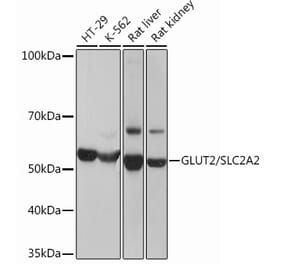 Western Blot - Anti-Glucose Transporter GLUT2 Antibody [ARC0305] (A307905) - Antibodies.com