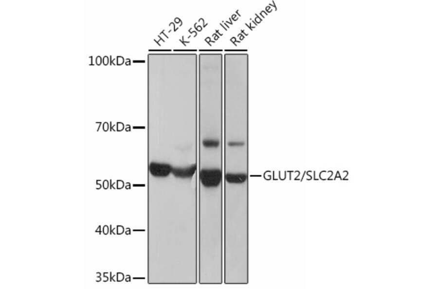 Western Blot - Anti-Glucose Transporter GLUT2 Antibody [ARC0305] (A307905) - Antibodies.com