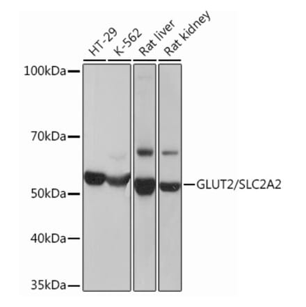 Western Blot - Anti-Glucose Transporter GLUT2 Antibody [ARC0305] (A307905) - Antibodies.com