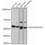 Western Blot - Anti-Glucose Transporter GLUT2 Antibody [ARC0305] (A307905) - Antibodies.com