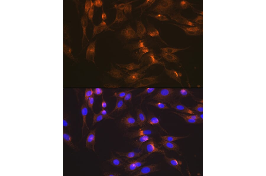 Immunofluorescence - Anti-Glucose Transporter GLUT2 Antibody [ARC0305] (A307905) - Antibodies.com