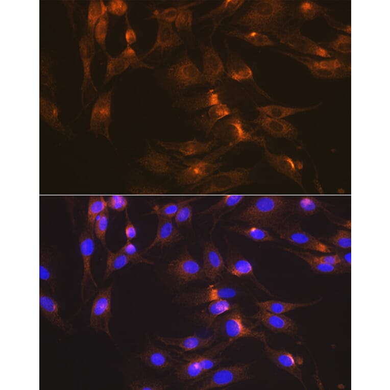Immunofluorescence - Anti-Glucose Transporter GLUT2 Antibody [ARC0305] (A307905) - Antibodies.com