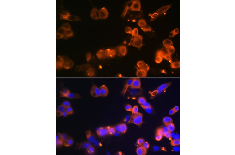 Immunofluorescence - Anti-Glucose Transporter GLUT2 Antibody [ARC0305] (A307905) - Antibodies.com