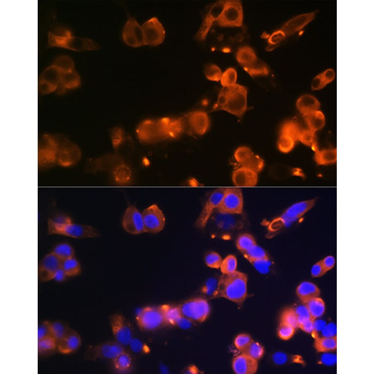 Immunofluorescence - Anti-Glucose Transporter GLUT2 Antibody [ARC0305] (A307905) - Antibodies.com