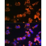 Immunofluorescence - Anti-Glucose Transporter GLUT2 Antibody [ARC0305] (A307905) - Antibodies.com