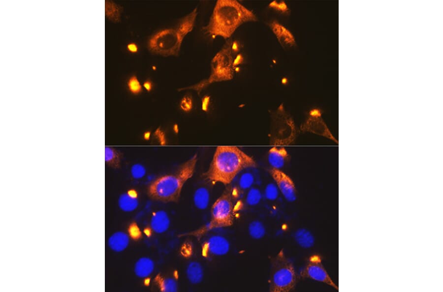 Immunofluorescence - Anti-Glucose Transporter GLUT2 Antibody [ARC0305] (A307905) - Antibodies.com